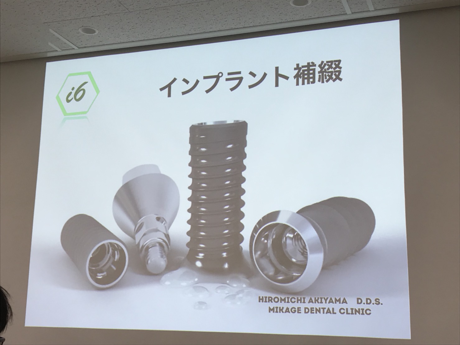 ストローマン インプラントセミナー